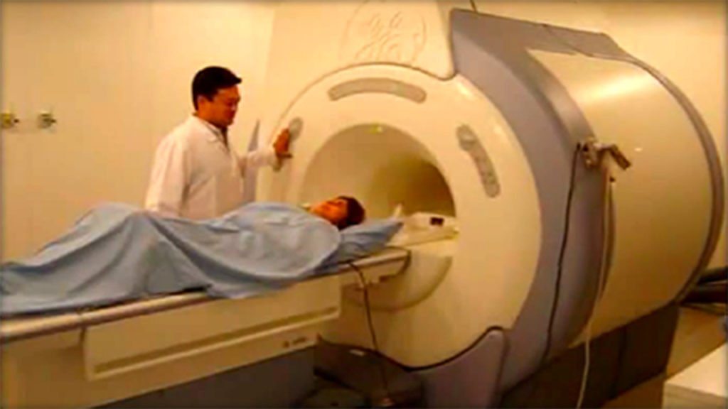 D-dimer test image